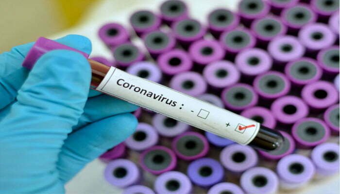 चेतावनी के बावजूद पार्टी का आयोजन करने पर आयोजक औऱ होटल संचालक पर FIR 1 Cg Corona 1