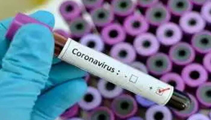 एमपी में फिलहाल कोरोना वायरस को कोई मरीज नहीं, 104 कॉल सेंटर सक्रीय 1 corona virus in mp