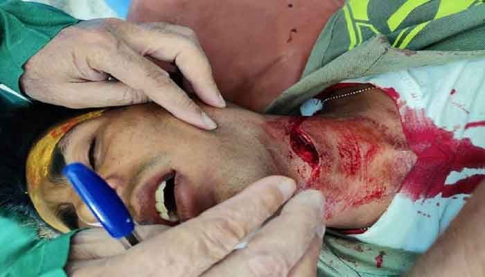 मकर संक्रांति पर पतंगबाजी में चाइनीज मांझा से 12वीं के स्टूडेंट का गला कटा, 3 लोग छत से गिरे, 8 साल का बच्चा गंभीर 1 gala