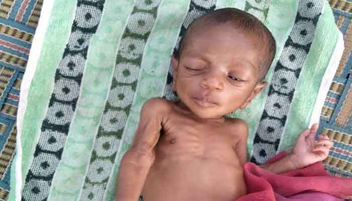 9 महीने के बच्चे को पोषण पुनर्वास केंद्र से ले गई मां, कहा- यहां न खाना मिलता है और न ही डॉक्टर आते हैं 1 child