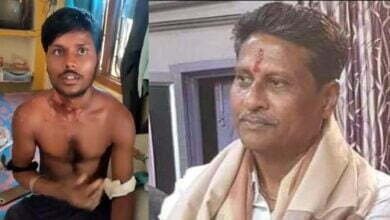 Photo of विरोध को गेंहू के बोरे, और FiR से दबाने की कोशिश ? विधायक पति पर, घायल छात्र के गंभीर आरोप