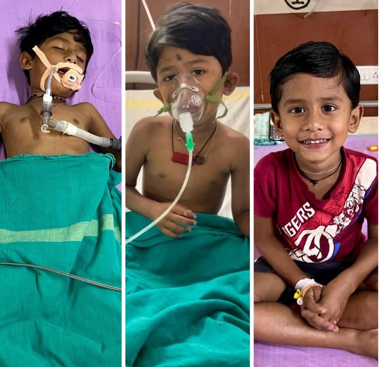 An innocent child who was dying due to the bite of a krait got a new life in the Medical College Hospital.