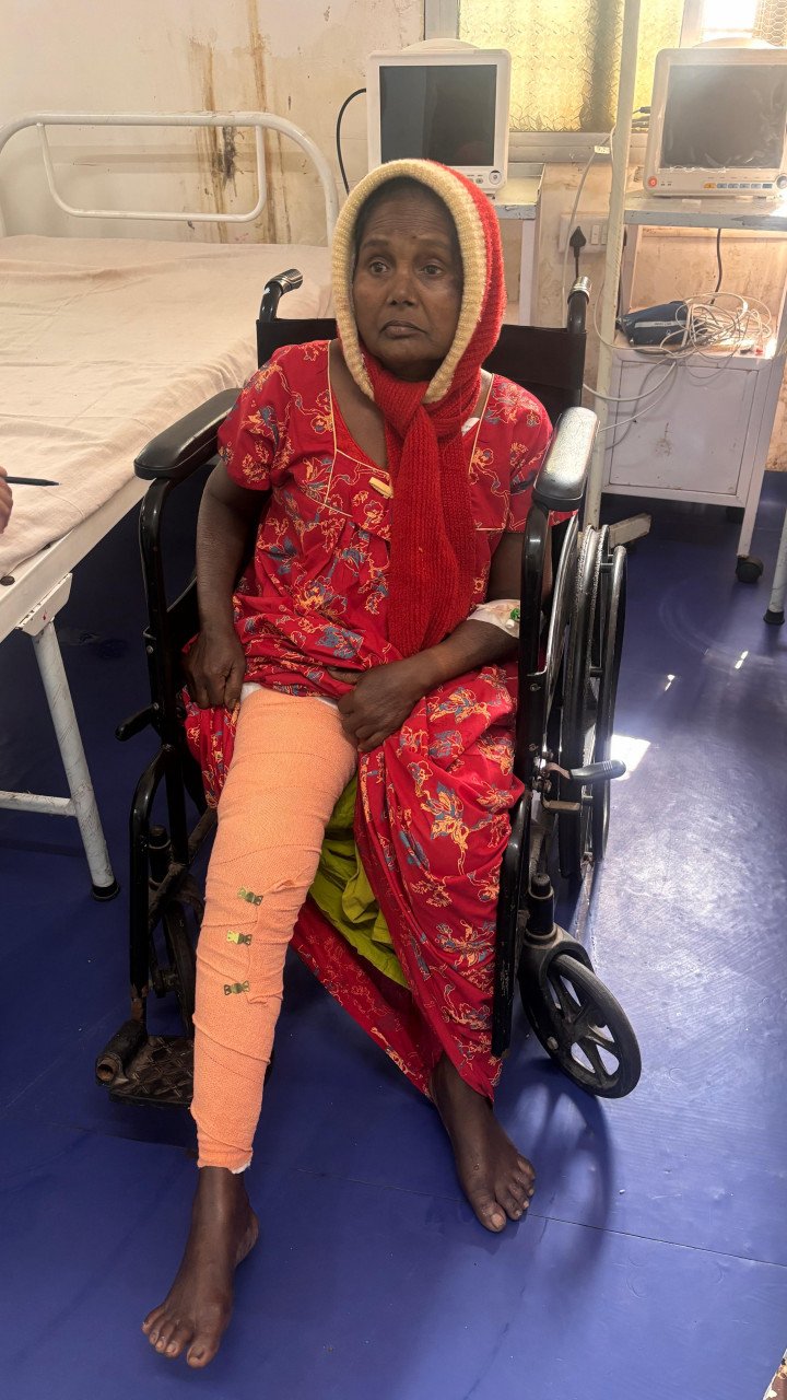 Dantewada District Hospital performs first total knee replacement, gives tribal woman a pain-free life