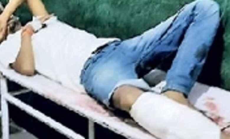 Bihar: Notorious dacoit behind ₹27 lakh heist shot in the leg; a massive strike by Patna Police!
