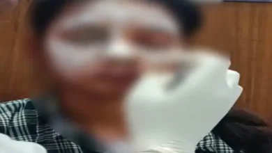 balod-acid-attack-on-college-girl-chhattisgarh